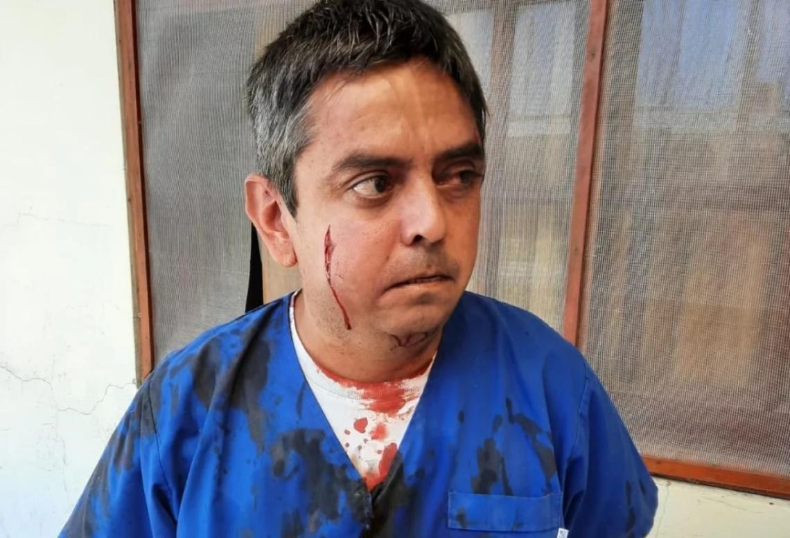 General Lavalle: un hombre agredió a golpes de puño al secretario de Salud  | Entrelíneas.info
