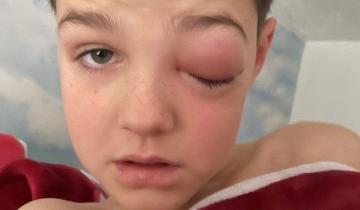 Imagen de "Ojo covid": un nene de 9 años casi pierde la visión tras contagiarse coronavirus