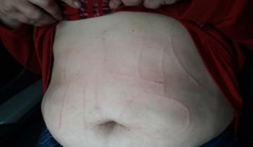 Imagen de Secuestraron a una docente y le escribieron la panza con un punzón