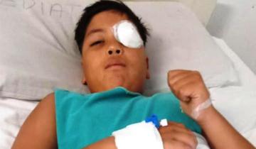 Imagen de Miramar: apedrearon un micro con jugadores de fútbol infantil y le produjeron heridas graves en el ojo a un chico de 11 años
