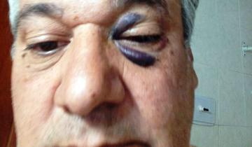 Imagen de Partido de La Costa: un vecino denunció que fue golpeado por el intendente de General Lavalle