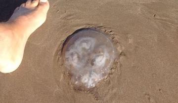 Imagen de Hay una invasión de aguas vivas gigantes en las playas de Mar del Plata