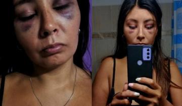 Imagen de Una mujer de Mar de Ajó denunció por una brutal golpiza a su ex pareja: “Él sigue haciendo su vida normal y yo no salgo por vergüenza”