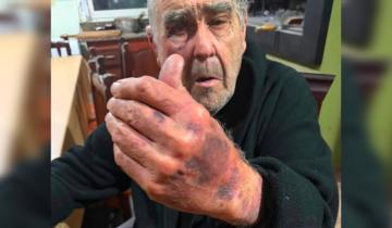 Imagen de Violento asalto a una pareja de adultos mayores en Paraje Pavón: denuncian que fueron brutalmente golpeados por cuatro delincuentes