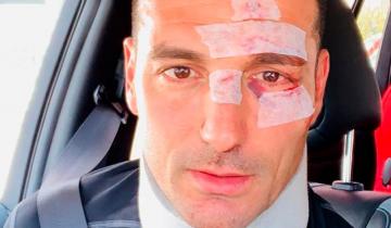 Imagen de Lionel Scaloni sufrió un accidente vial pero comunicó que está bien