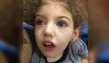 Imagen de Piden ayuda para Isabella, una nena de 4 años que necesita urgente un tratamiento neurológico